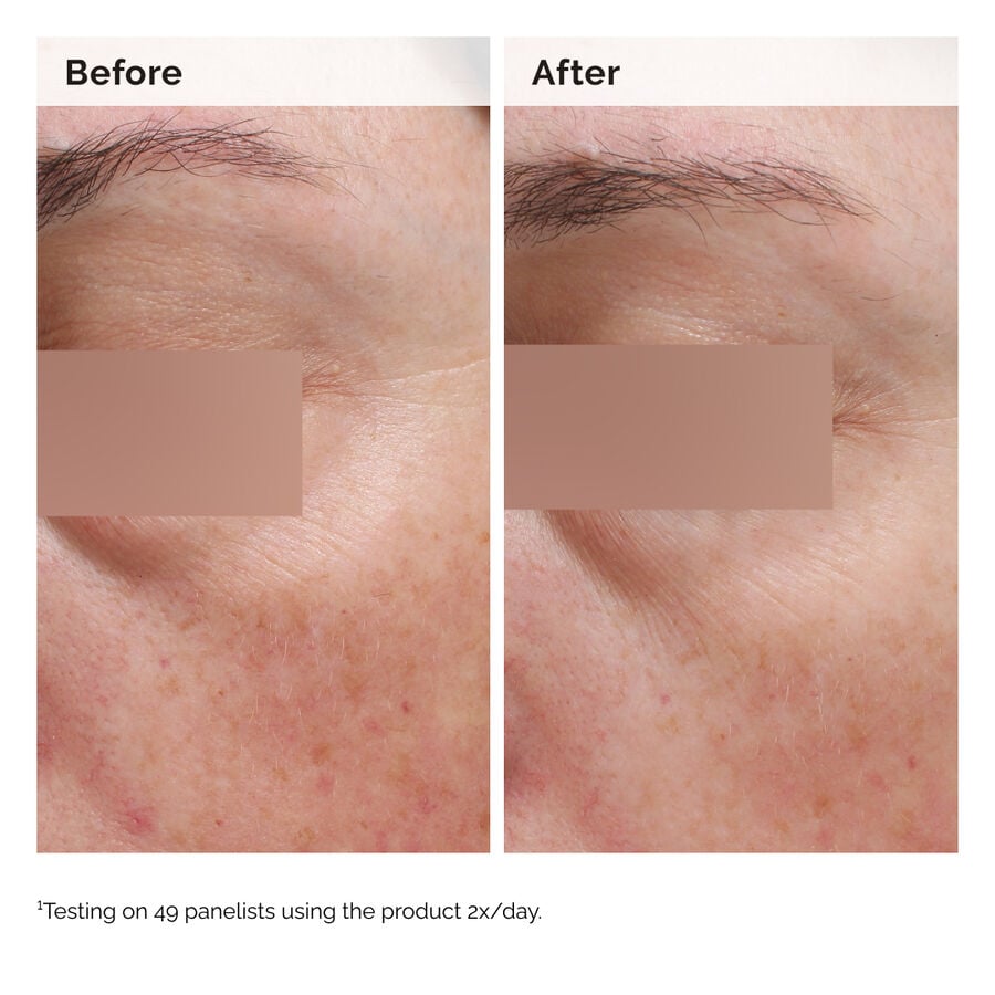 niacinamide-5-face-and-body-emulsion-o0 2024-08-23-ORD-Nia-5pct-Face-Body-B-A-Elasticity-Global-02-1x1.jpg
