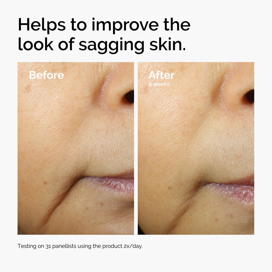 caffeine-3-escin-1-face-serum-b4 ord-caffeine-3pct-escin-1pct-face-serum-before-after-sagging.jpg