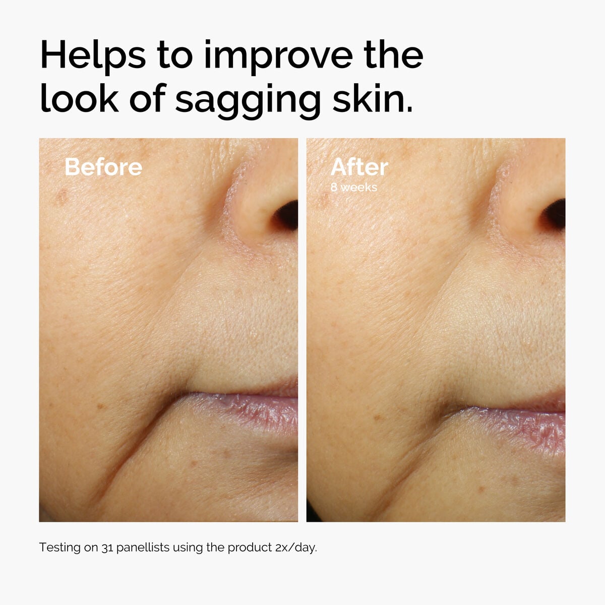 caffeine-3-escin-1-face-serum-b4 ord-caffeine-3pct-escin-1pct-face-serum-before-after-sagging.jpg