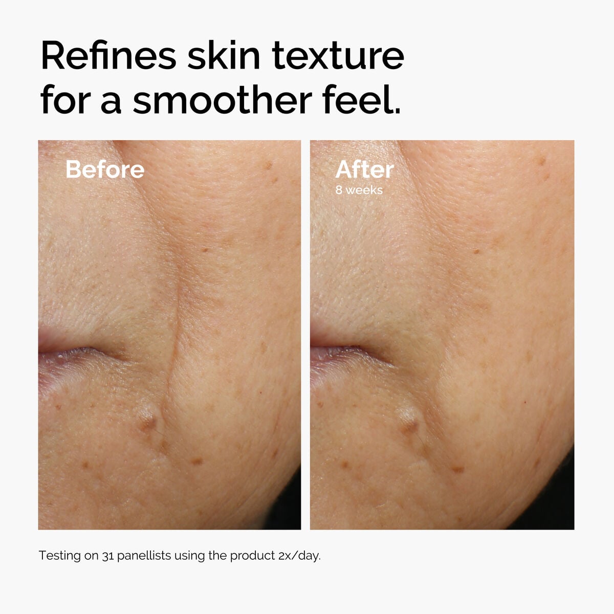 caffeine-3-escin-1-face-serum-b4 ord-caffeine-3pct-escin-1pct-face-serum-before-after-texture.jpg