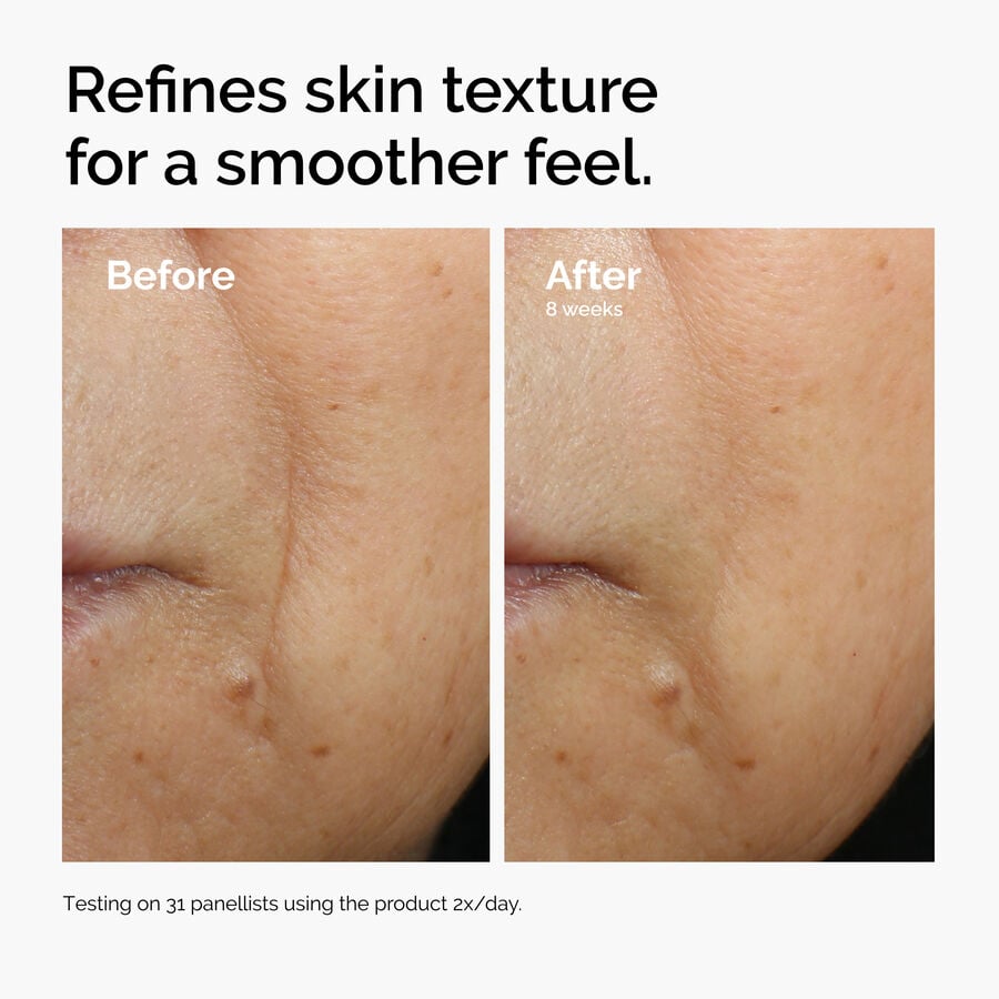 caffeine-3-escin-1-face-serum-b4 ord-caffeine-3pct-escin-1pct-face-serum-before-after-texture.jpg
