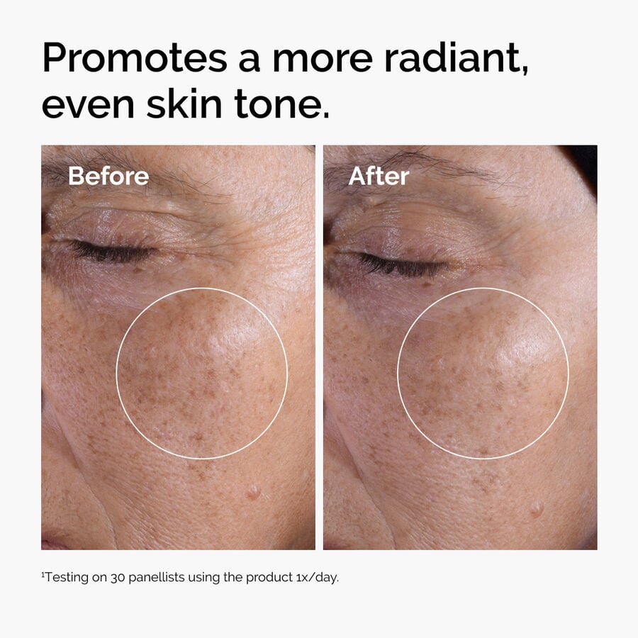 glycolic-acid-7-exfoliating-toner-a1 ord-glycolic-before-after-radiance.jpg