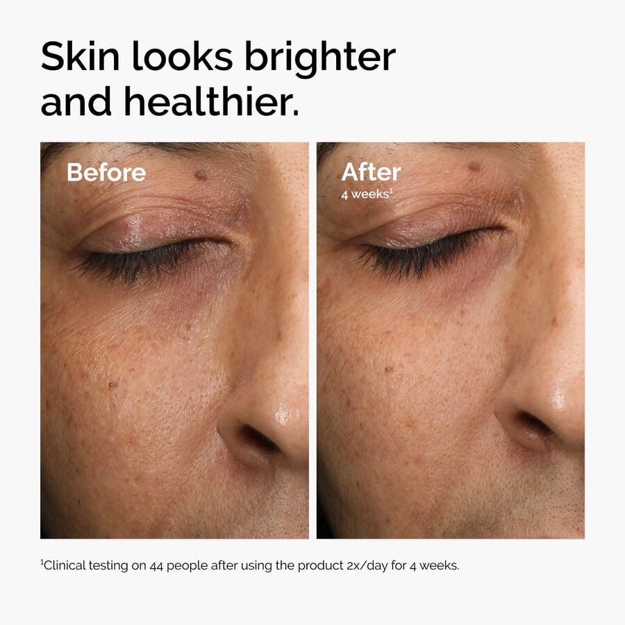 multi-antioxidant-radiance-serum-s7 ord-mars-before-after-healthy.jpg