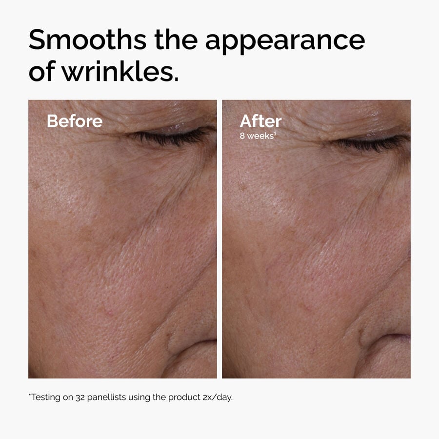 multi-peptide-ha-serum-g6 ord-multi-peptide-ha-serum-wrinkles-before-after.jpg