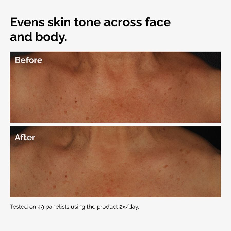 the-body-care-collection-m0 ord-niacinamide-face-body-serum-before-after-even-tone-graphic.jpg
